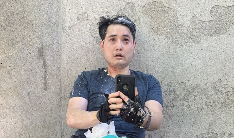 Selfie of Andy Ngo post-attack